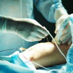 Vascular Surgeons In Trauma Cases
