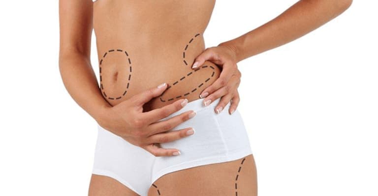 Process Of Liposuction