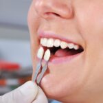 family dentist in Whitby