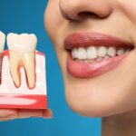 Should you replace your dentures with dental implants? Check here!