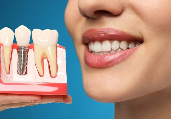 Should you replace your dentures with dental implants? Check here!