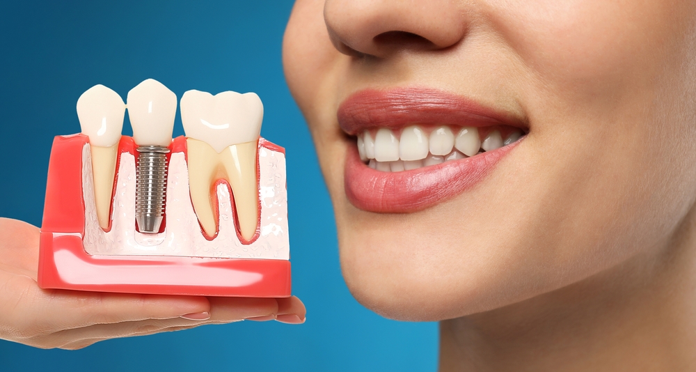 Should you replace your dentures with dental implants? Check here!