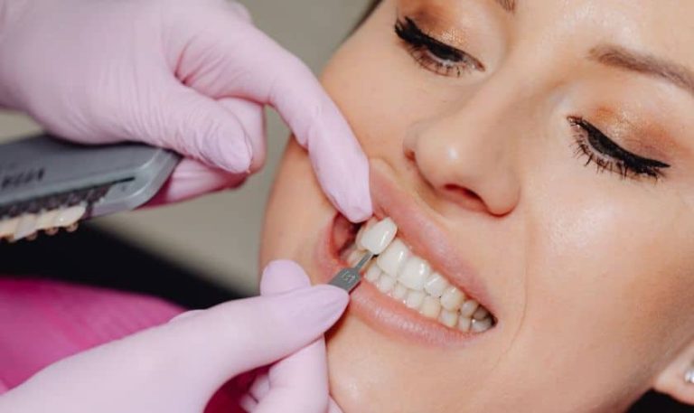 Fresno cosmetic dentist