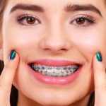 orthodontist in La Quinta