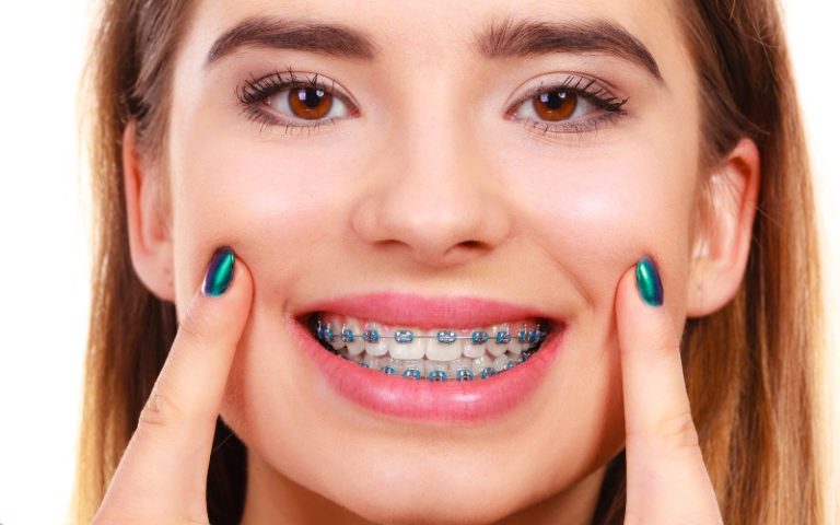 orthodontist in La Quinta